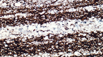 Eagle Ford photomicrograph showing light laminae of foraminifera tests and dark laminae of clay and organic matter. The intervals enriched in foram tests are the better reservoirs. Eagle Ford photomicrograph showing light laminae of foraminifera tests and dark laminae of clay and organic matter. The intervals enriched in foram tests are the better reservoirs.