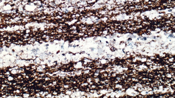 Eagle Ford photomicrograph showing light laminae of foraminifera tests and dark laminae of clay and organic matter. The intervals enriched in foram tests are the better reservoirs.