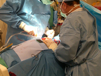 The team watching Texas Heart Institute surgeons implant an artificial heart into a cow in 2011.