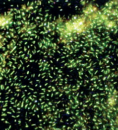 Fig. 2. This photomicrograph uses epifluorescent microscopy to show common waterborne bacteria in a guar solution (100X magnification). The cloudy regions are guar residue.  