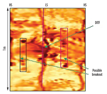 Fig. 6. Example of a DITF showing subvertical conductive fractures 180° apart from each other and localized interval of possible incipient breakout, electrical image (memory).